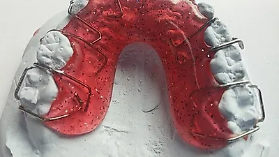 '임플란트와 틀니' , 나에게 맞는 보철치료는?…"알아두면 좋아요"