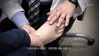 [생로병사의비밀] 통풍 원인, 요산이 뭐길래? '통풍에 좋은 음식 VS 통풍에 안좋은 음식' 통풍 치료하기