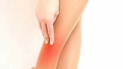하지정맥류 증상 방치했다가 더 큰 합병증 불러와…하지정맥류 증상 및 치료법·예방법
