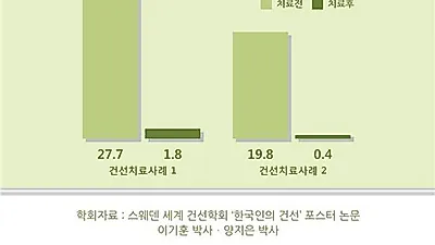 편도염, 감기는 피부 건선 발생의 주요 계기, 특히 젊은 층 주의해야