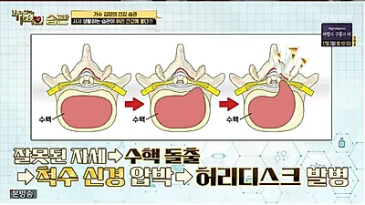 김양, 집안에서도 서 있는 습관 “다이어트+허리디스크에 도움”