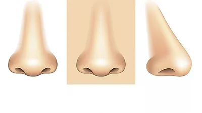 코 재수술, 부작용 피해 꼼꼼하게 따져봐야