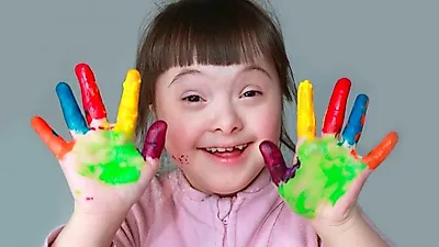 다운증후군 증상과 원인, 개선방법은?