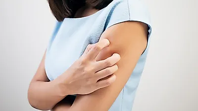 [여름철 피부질환] 피부 가려움증 원인, '면역력 높이는 방법'과 '면역력 높이는 음식'으로 해결