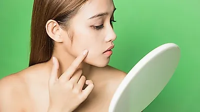 눈밑 피부에 '오돌토돌' 비립종 원인이 대체 뭐지?....함부로 짜면 큰일나, 비립종 원인과 치료법은?