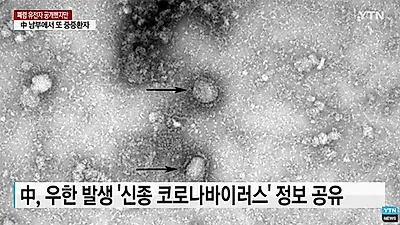 신종 코로나 바이러스 태국에서도 발견 확산 ‘비상’ 중국 폐렴 초기증상은?