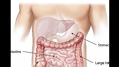 소화기관 어디서나 발생할 수 있는 크론병…주요 증상과 좋은 음식