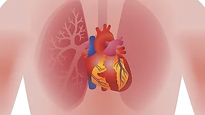 [환절기건강관리]"답답한 가슴 방치하면 안돼"찬 겨울 더 심해지는 심장 질환 '심근경색' 초기증상, 원인, 치료법까지