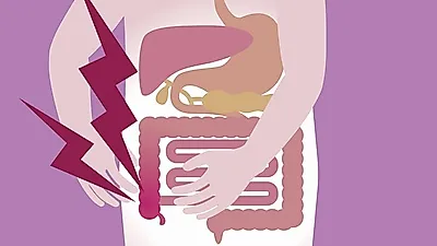 골반염처럼 국소부위 저림, '맹장염 초기증상' 오른쪽 아랫배 통증으로 시작... 맹장염 수술 회복기간은?