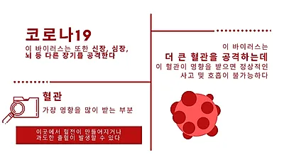 코로나19 감염된 젊은 환자 ‘뇌졸중’ 발생 사례 보고