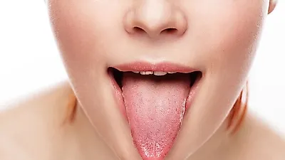 건강이상이 오면 혀에도 나타난다?   혀갈라짐 원인과 치료하는 방법
