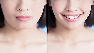 방치하면 안면비대칭까지... 턱관절통증 원인과 치료법을 알아보자