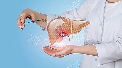 지방간 증상->간경화 증상->간암 초기증상으로 발전 주의! 간+지방간+간경화에 좋은 음식 10