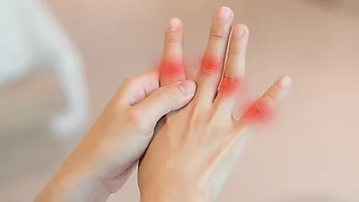 관절에 열감과 부기가 생긴다면…통풍 초기증상 및 원인