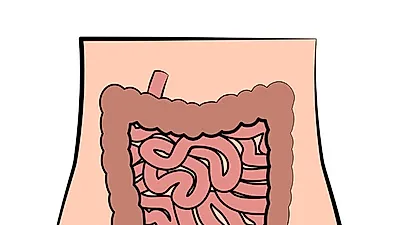 맹장염 커지면  합병증으로 이어져…  맹장염 원인 및  남자·여자 맹장 위치는?  맹장수술 '이 방법'으로 실행해