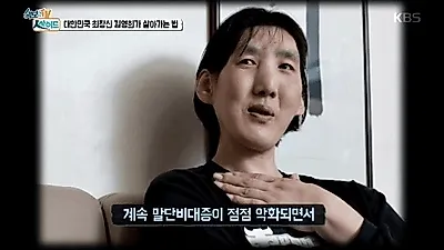농구선수 '김영희' 거인병과 우울증으로 남모를 고통으로 자살 기도까지…안타까운 근황