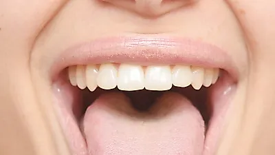 갈라지는 혓바닥   평소 건강상태로 유발?   원인에 따른 치료방법
