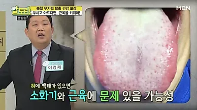 [혀로 보는 건강] 혀 갈라짐(세로줄)·혀 백태·혀 색깔, '혀 건강상태' 의심! 혀 백태 원인·제거 법도