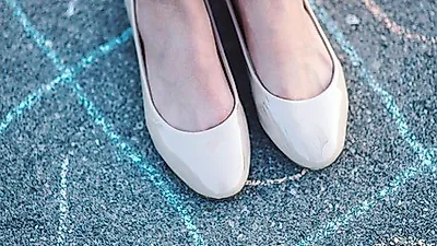 수술이 꼭 필요한 하지정맥류?   초기증상 무시하면 안돼