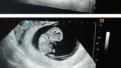 장성규, 둘째 초음파 영상에 "춤을 추네" 뱃속에서도 남다른 끼 발산 무슨 일? '10년 열애' 및 아내와의 나이차이 눈길
