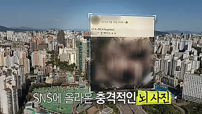'실화탐사대' 서울 국립병원 신경외과 의사 누구? SNS에 뇌사진 인증샷, 무리한 수술까지