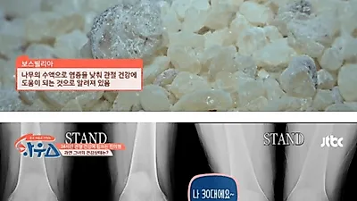 보스웰리아 효능 '가수 진미령 30대 무릎의 비결?' 부작용 피하려면 '이것' 확인은 필수 '먹는 법 및 연고 만드는 법' 정리