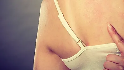 '피부 가려움증', 몸이 가려운 이유는? '콜린성 두드러기·급성 두드러기', 두드러기 증상·치료법도