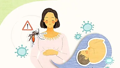 지카 바이러스가 발생 시키는 소두증