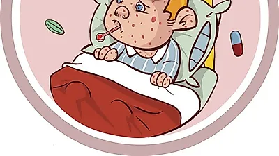 주변에 있으면 90% 전염된다고? 홍역 증상과 치료에 대해 알아보자