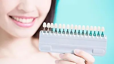 [치아 미백] 누런이빨, 탈피하고 싶다면…셀프치아미백 방법은?