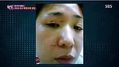 라윤경 폭행 사진에 '깜짝' 아들 수찬 있는데도 머리잡고 목 가격, 초등학생 입에서 '외롭다'.. 왜?