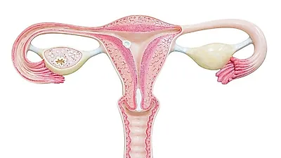 '침묵의 살인자', 난소암 초기증상...5년 생존율 40% 이하