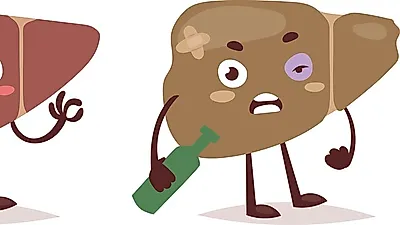 지방간, 전신 권태감의 원인…'지방간에좋은음식 및 운동은 무엇?'