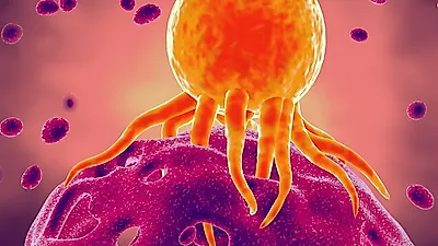 전연령대에 발생할 수 있는 '지방종'…제거수술 꼭 필요할까?