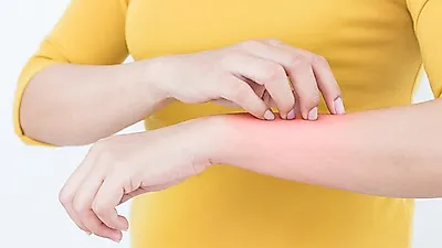 눈물이 나올 정도로 아프다는  '대상포진' 초기증상이 어떻길래… 예방주사가 맞는 Tip?