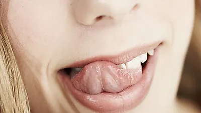따가움 유발하는 혀갈라짐…'혀로 보는 건강상태'   혀갈라짐 원인 및 치료법
