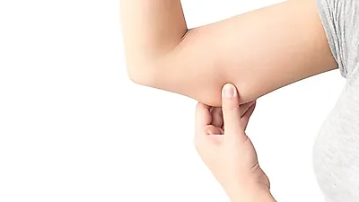 빼도 잘 빠지지 않는 팔뚝살 어떻게 빼는게 좋을까?