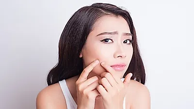 피부에 '볼록볼록'   쥐젖, 제거할 수 있을까? … 갑작스런 체중 증가가 원인일 수도