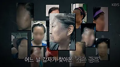 "곱게 늙고 싶었는데" 악마의 가루 헤나염색 부작용, 헤나방 천연 염색약 덜컥 믿었다가..