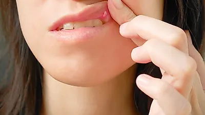 심각한 합병증을 유발하는 염증성 질환 '베체트병' 증상과 치료법은?