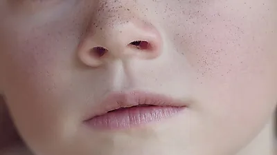 갑자기 얼굴에 생기는 기미, 간단한 '집에서기미없애는방법'