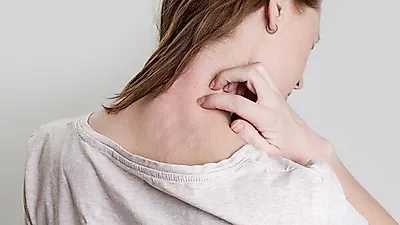 당뇨 환자, 설연휴기간 설음식만큼 '대상포진' 주의해야...초기증상은?