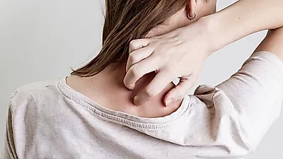 대상포진 초기증상 "알아봤자 소용없어" 예방접종 주의사항은? 대상포진에 좋은 음식과 면역력 높이는 방법