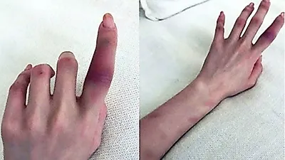 정다은-한서희 결별? 이유에 폭력 컸나 "나 죽일려고 해"