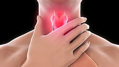 침삼키다 스트레스! '역류성식도염' 증상, 목이물감과 끊임없는 마른기침... 역류성식도염에 좋은 음식