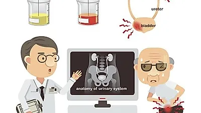 오줌에서 피가 나고 아랫배 통증이?…방광염의 증상 및 원인
