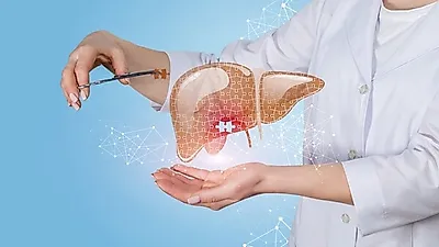 지방간·당뇨에 좋은 음식 '엉겅퀴(밀크씨슬)' 효능·부작용은? 실리마린↑ 밀크시슬 복용 시간도