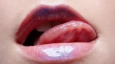 쩍쩍 갈라지는 혀 갈라짐 원인…혀로 보는 건강,  혀갈라짐 원인 및 치료법