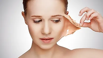 하얗게 뜬 '얼굴 각질' 제거할 수 있을까?…각질 제거법 중 '이것'이 가장 중요!