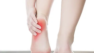 족저근막염, 과체중인 사람이 더 쉽게 걸려